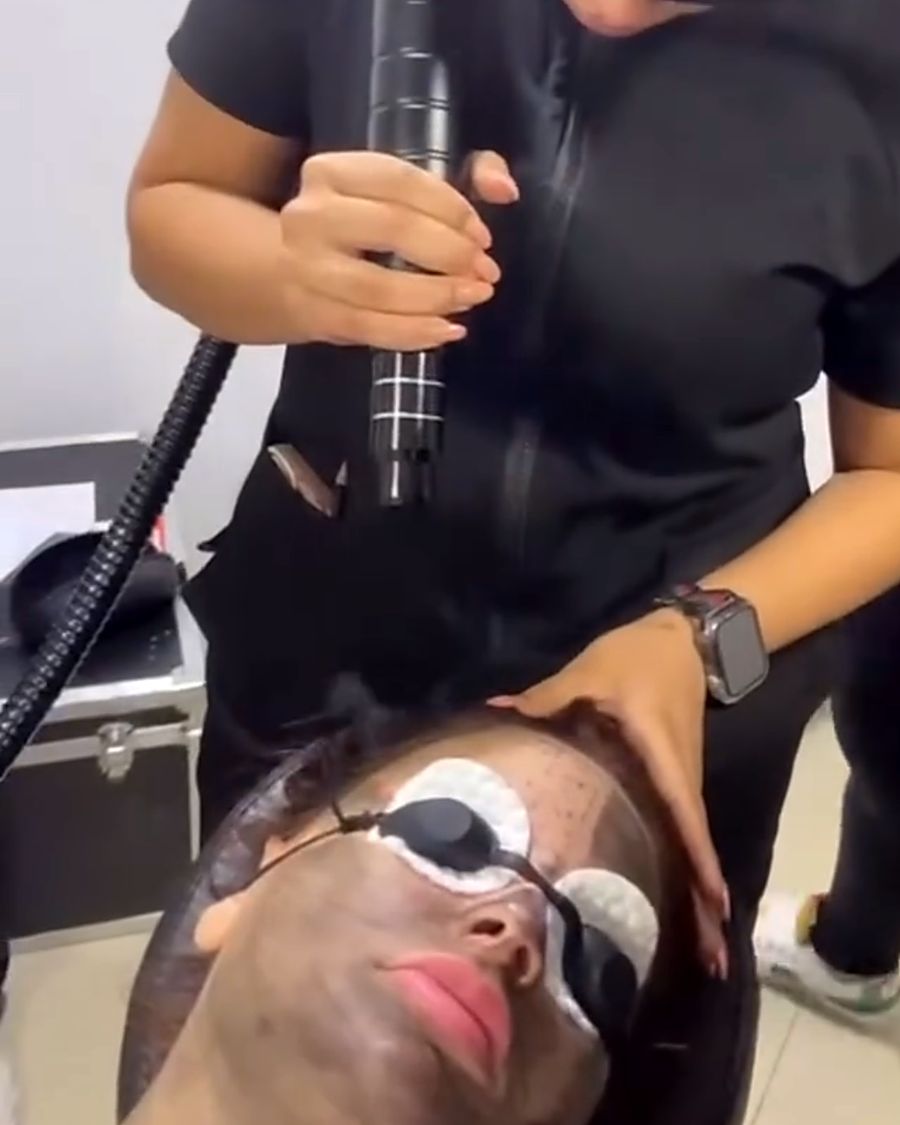 Tratamiento láser con protección ocular